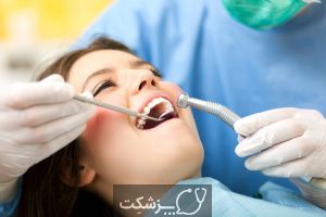 پری کورونیت دندان | پزشکت