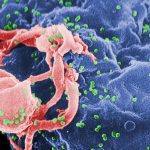علائم اولیه ابتلا به ویروس HIV
