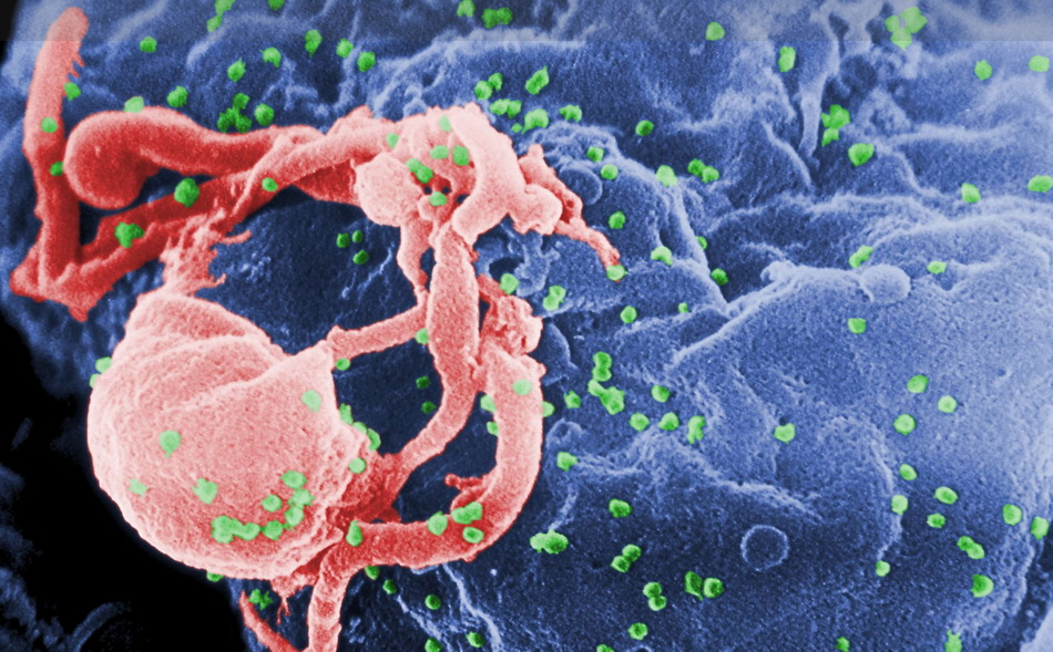 علائم اولیه ابتلا به ویروس HIV | پزشکت