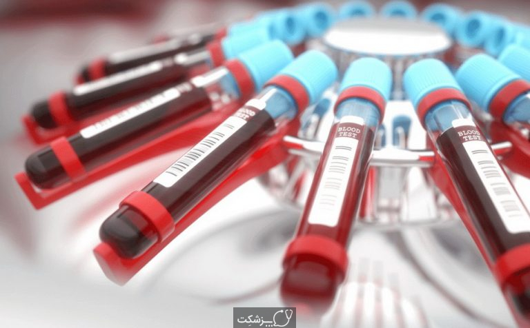 آزمایش الکتروفورز هموگلوبین چیست؟ | پزشکت