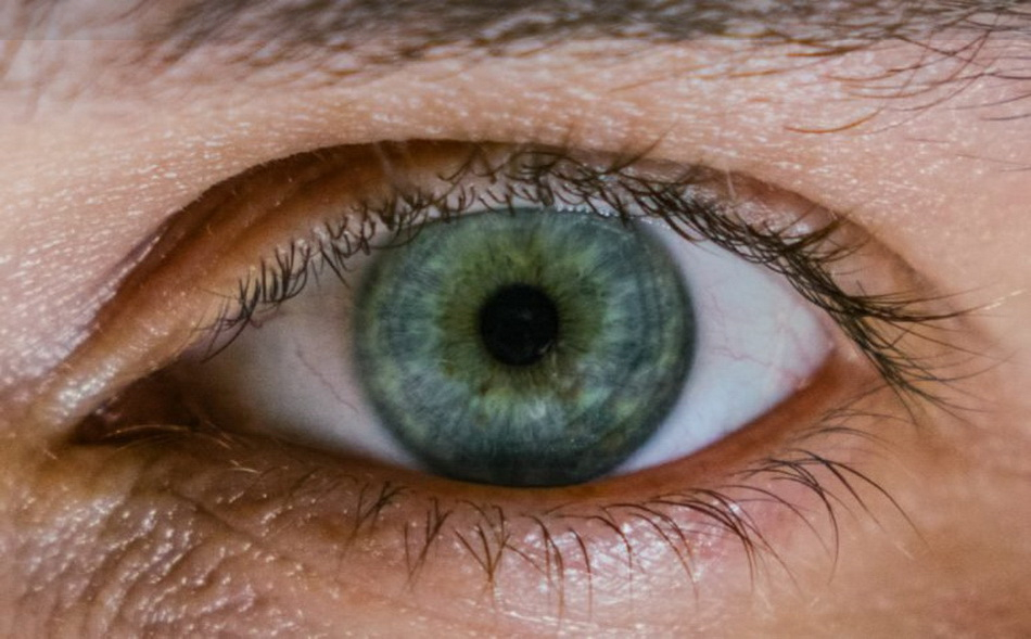 تنگ شدن مردمک چشم نشانه چیست؟ | پزشکت