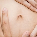 جدا شدن عضلات شکمی در بارداری
