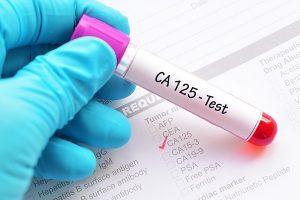 آزمایش خون CA-125 یا آنتی ژن سرطانی | پزشکت