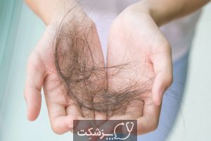 ریزش مو در نوجوانان و راه های درمان آن | پزشکت
