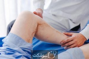 علت درد کف پا چیست؟ | پزشکت
