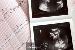پریشانی جنین چیست؟ | پزشکت