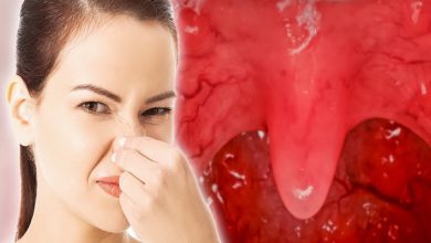 علت بوی بد بینی چیست؟ | پزشکت