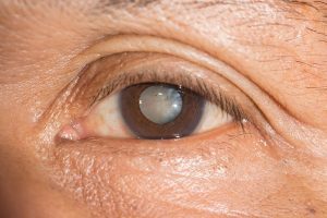 علائمی که نیاز به معاینه چشم دارید. | پزشکت