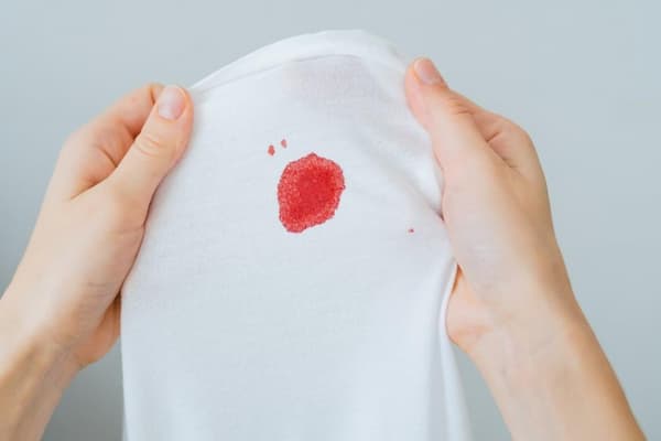 لکه بینی و ترشحات خونی در زنان-پزشکت