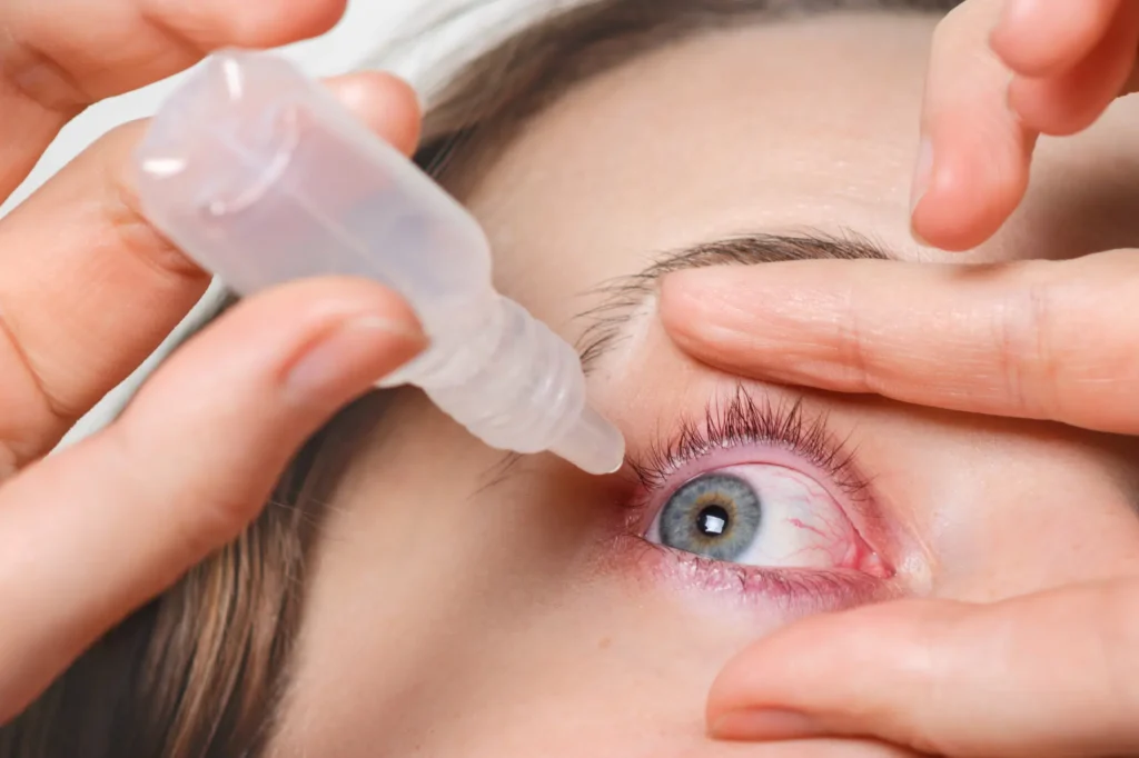 درمان خونریزی چشم با قطره چشمی-پزشکت