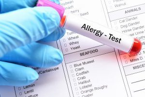 تست آلرژی چیست و چه کاربردی دارد؟ | پزشکت