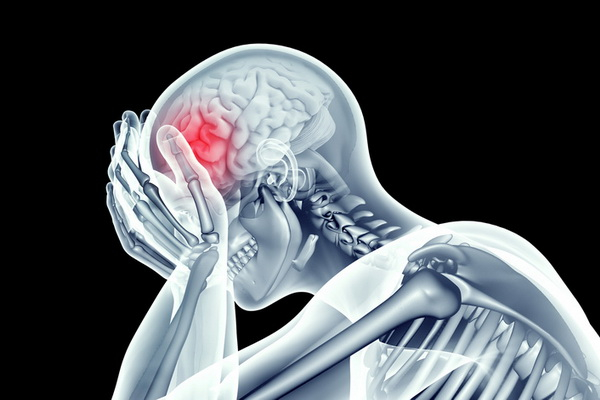 سندرم پس از ضربه مغزی چیست؟ | پزشکت