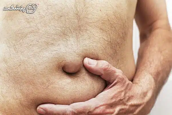 علل درد ناف | پزشکت