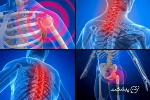 تفاوت بین فیبرومیالژیا و آرتریت روماتوئید