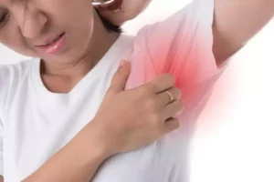 جوش زیر بغل | پزشکت