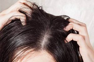شایع ترین عوارض صاف کردن مو | پزشکت