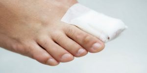 فرو رفتن ناخن پا | پزشکت