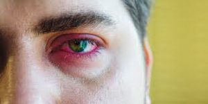 علت درد در یک چشم || پزشکت
