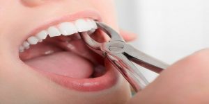 دندانپزشکی زیبایی چیست؟ | پزشکت