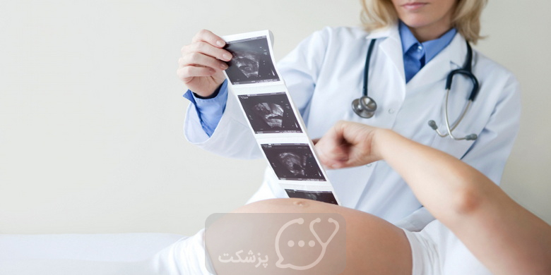 تعیین جنسیت جنین || پزشکت