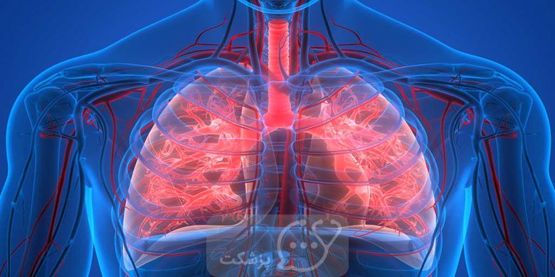 شایع ترین بیماری های ریه را بشناسید. || پزشکت