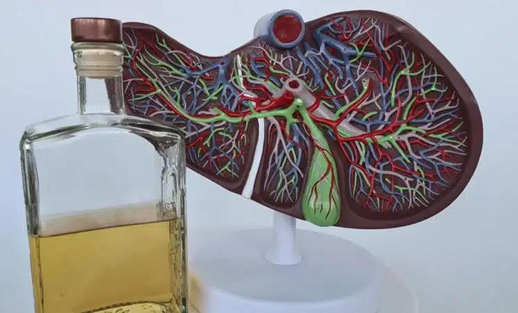 اسیدوز متابولیک | پزشکت