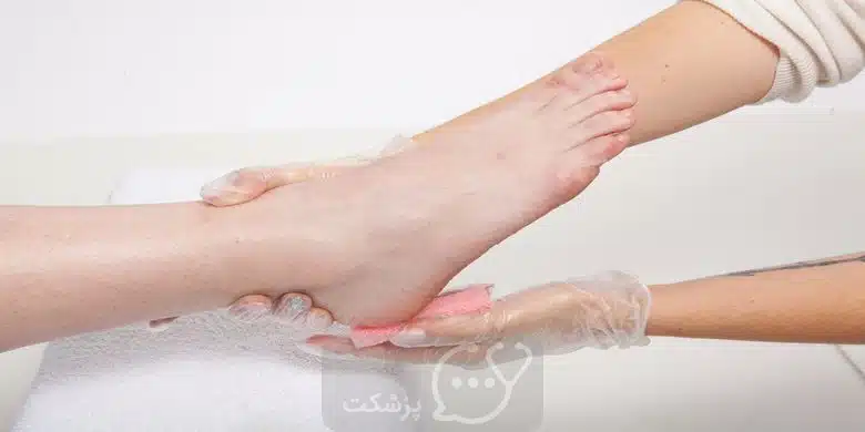ترک خوردگی پاشنه پا || پزشکت