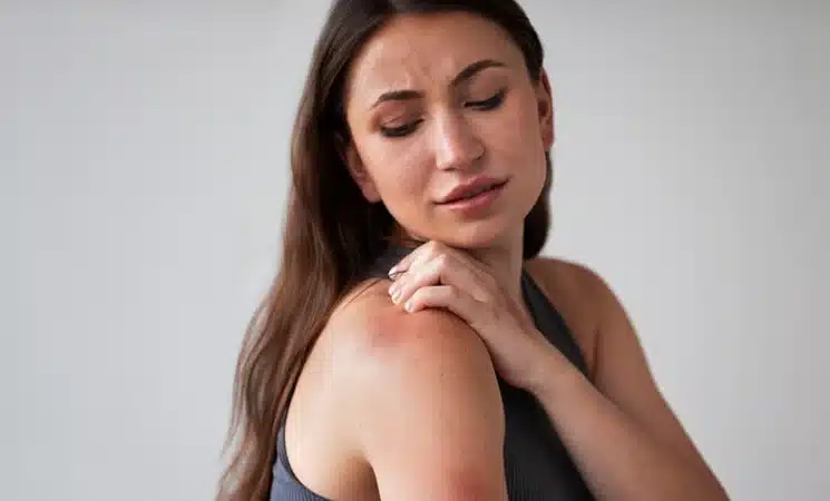  توده یا برآمدگی روی شانه | پزشکت