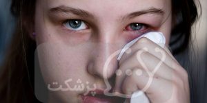 عوارض امیکرون و کرونای دلتا بر چشم || پزشکت