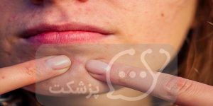 تغییر خال در بارداری || پزشکت