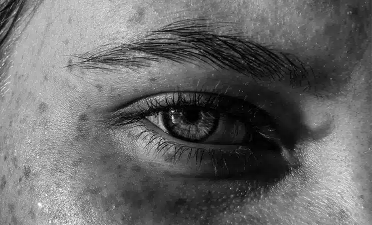 سیاهی رفتن چشم | پزشکت