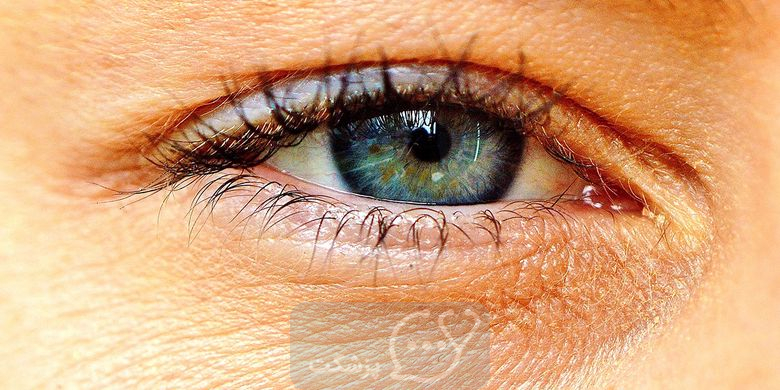 مایع اضافی در چشم چیست؟ || پزشکت