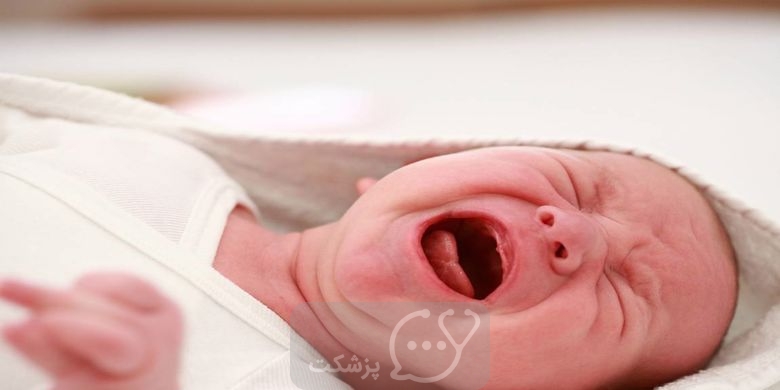 علت داغ بودن سر نوزاد بدون تب و راه های مقابله با آن چیست؟ || پزشکت
