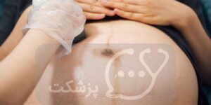 بارداری بعد از سزارین چه خطراتی دارد؟ || پزشکت