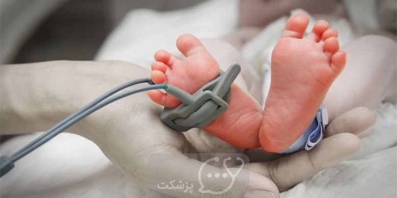 احتمال زنده ماندن نوزاد نارس چقدر است؟ || پزشکت