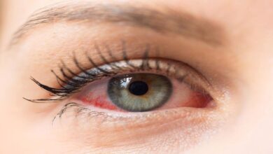 خشکی چشم پس از لیزیک و راه های درمانی آن || پزشکت