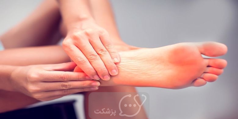 درد پاشنه پا || 8 علت درد پاشنه پا و گزینه های درمانی || پزشکت