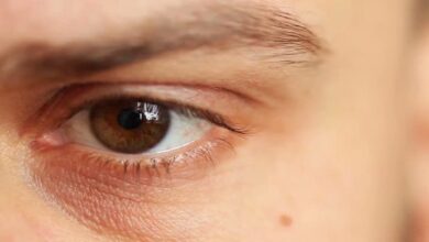 16 درمان خانگی موثر برای خارش چشم که نمی دانید! || پزشکت