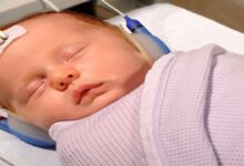 کم شنوایی مادرزادی از شایع ترین علل تا راه تشخیص و درمان || پزشکت