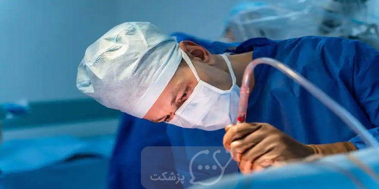 اسفنکتروتومی یا جراحی شقاق || پزشکت