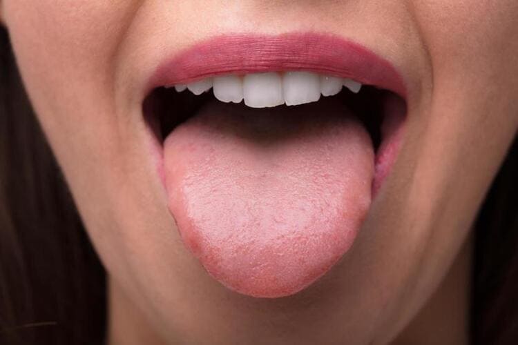درد زبان-پزشکت
