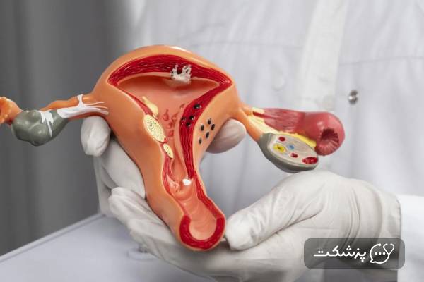 خطرات بارداری بعد از بستن لوله ها