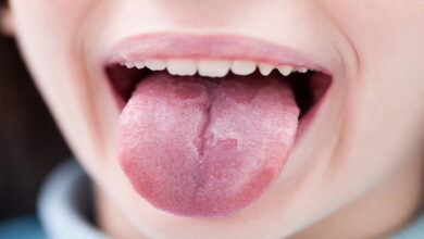 شایع ترین علل سوزن سوزن شدن زبان || پزشکت