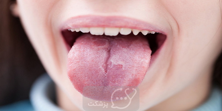 شایع ترین علل سوزن سوزن شدن زبان || پزشکت