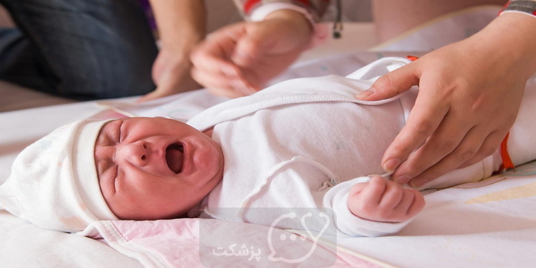 آترزی صفراوی در نوزادان || پزشکت