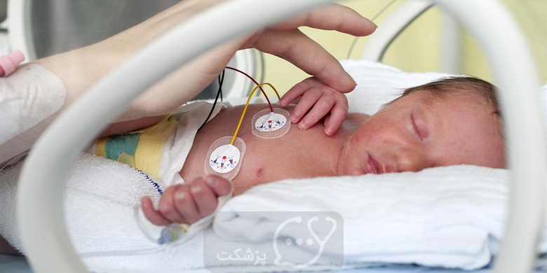 آکروسیانوز در نوزادان || پزشکت