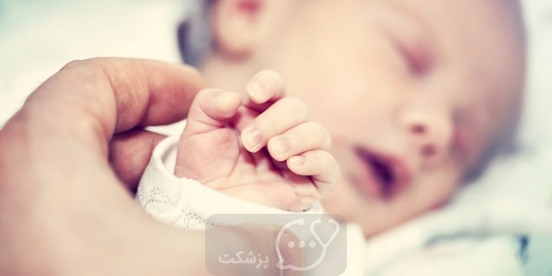 آکروسیانوز در نوزادان || پزشکت