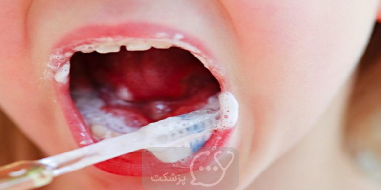 احساس طعم صابون در دهان || پزشکت