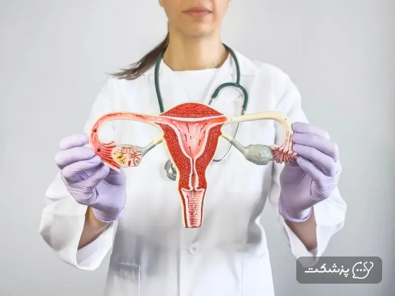 مدل آناتومی رحم و تخمدان در دستان پزشک متخصص