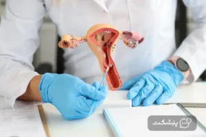 خارش واژن بعد از پریود